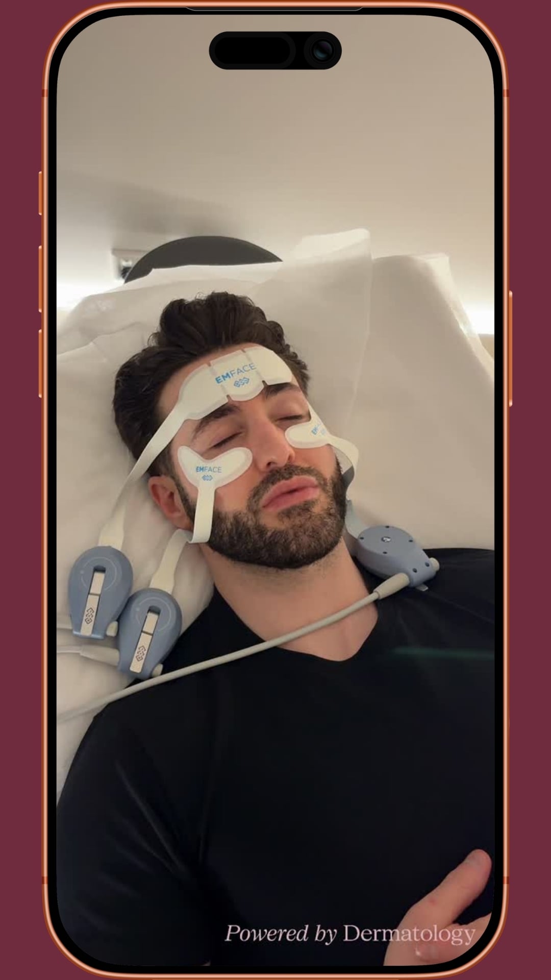 EMface treatment experience